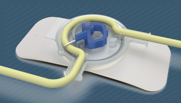 FoleySafe 2.0 Catheter Stabilizer