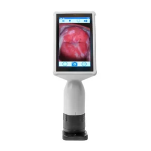 Eva Pro Digital Colposcope